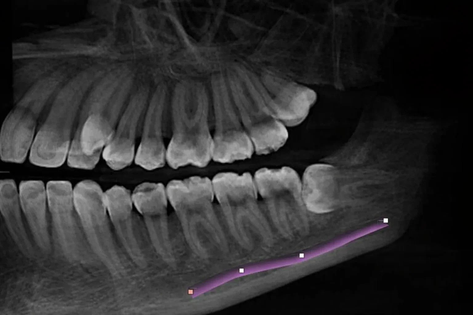 디지털 장비 활용 진단