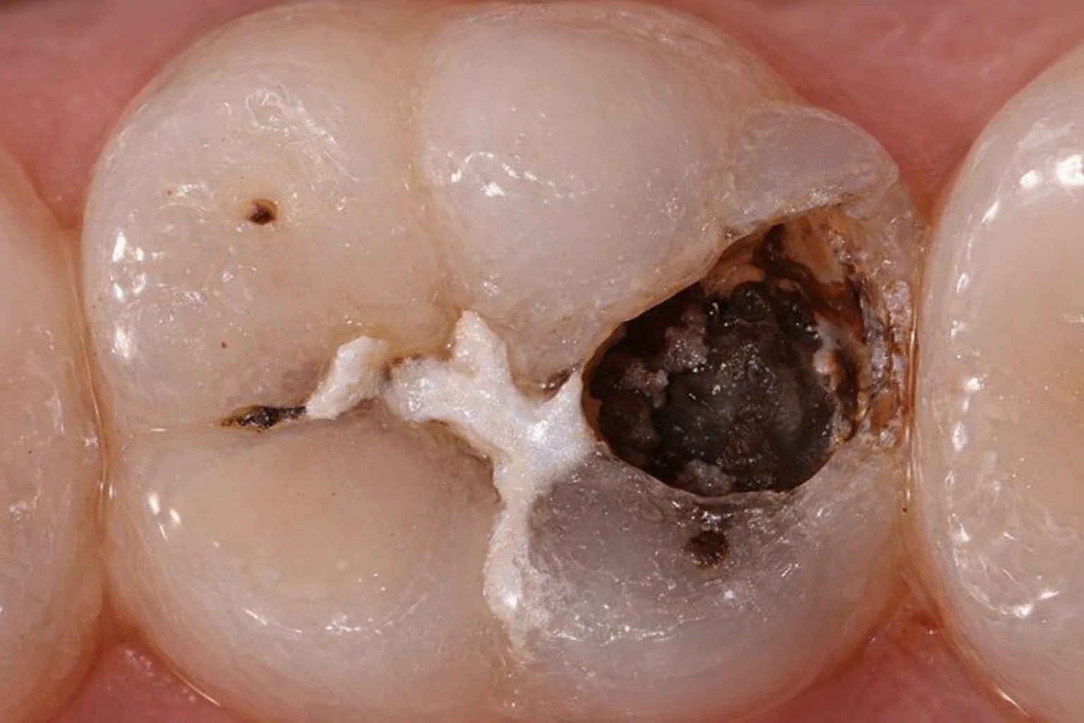 디지털 구강 검진