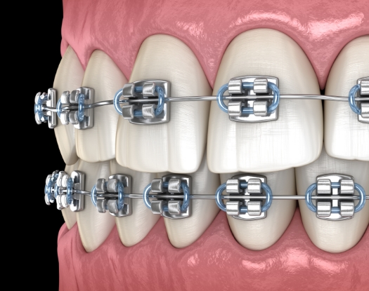 라미네이트 이미지